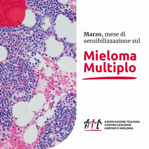 Roma: Ail, mese di sensibilizzazione su mieloma multiplo